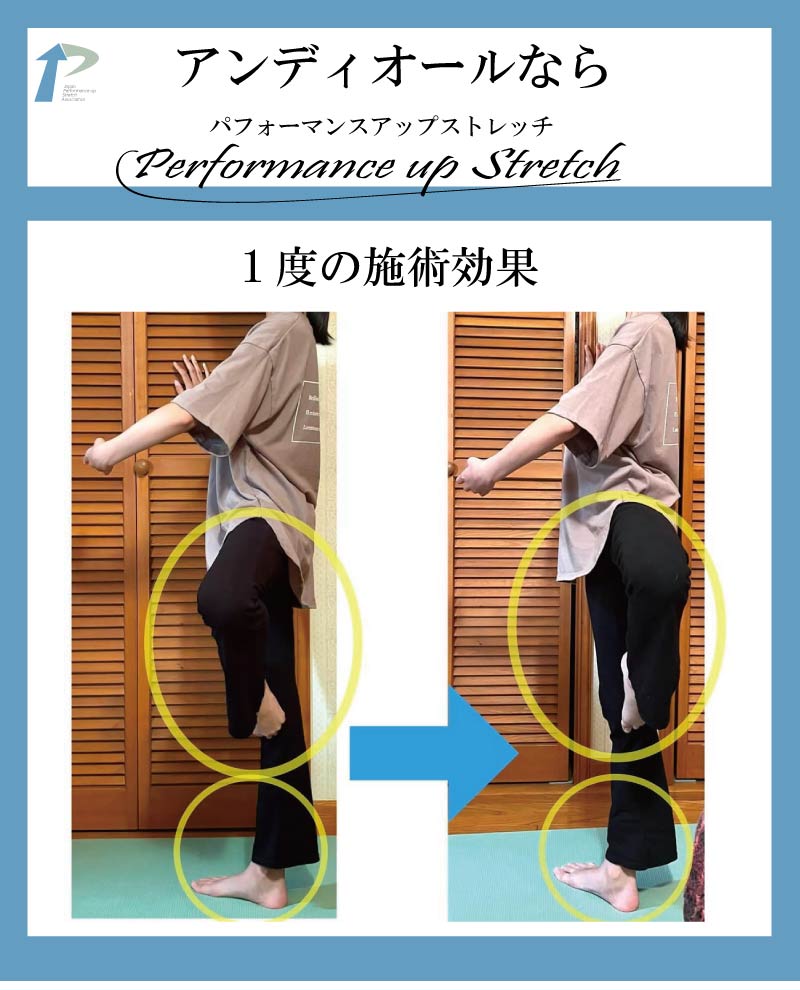 �o���G,����,�X�g���b�`,�A���f�B�I�[��