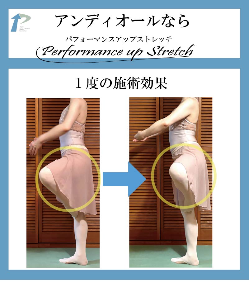 �o���G,����,�X�g���b�`,�A���f�B�I�[��