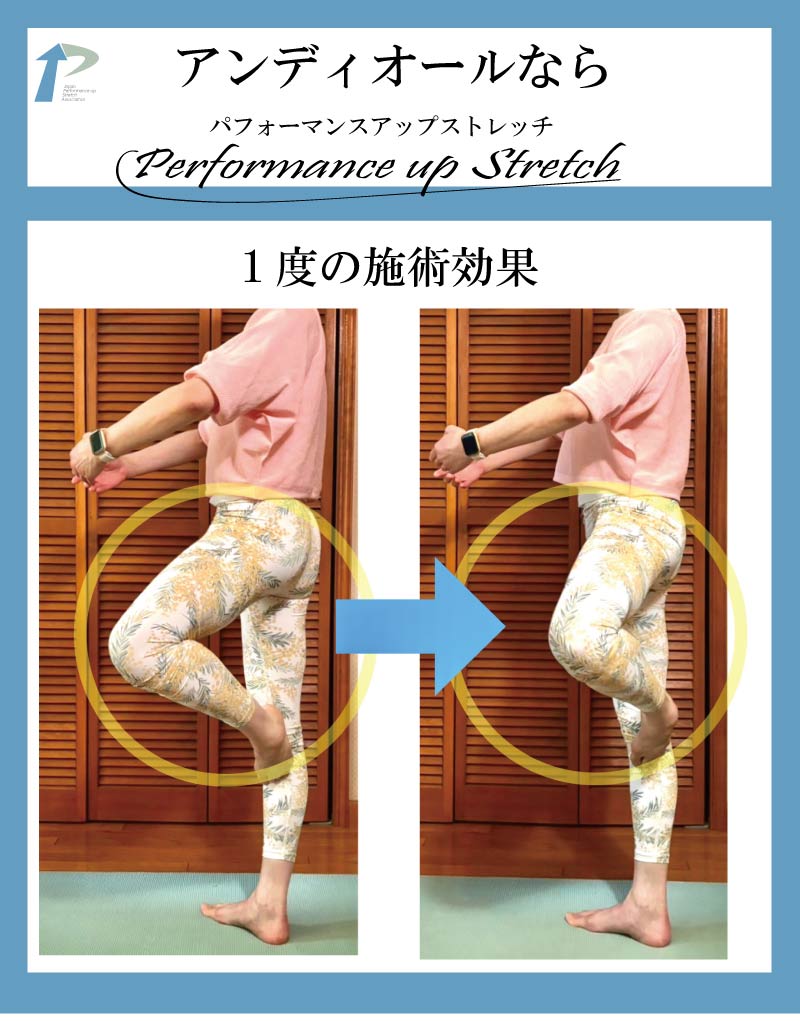 �o���G,����,�X�g���b�`,�A���f�B�I�[��