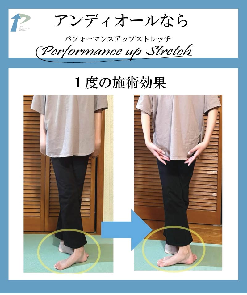 �o���G,����,�X�g���b�`,�A���f�B�I�[��