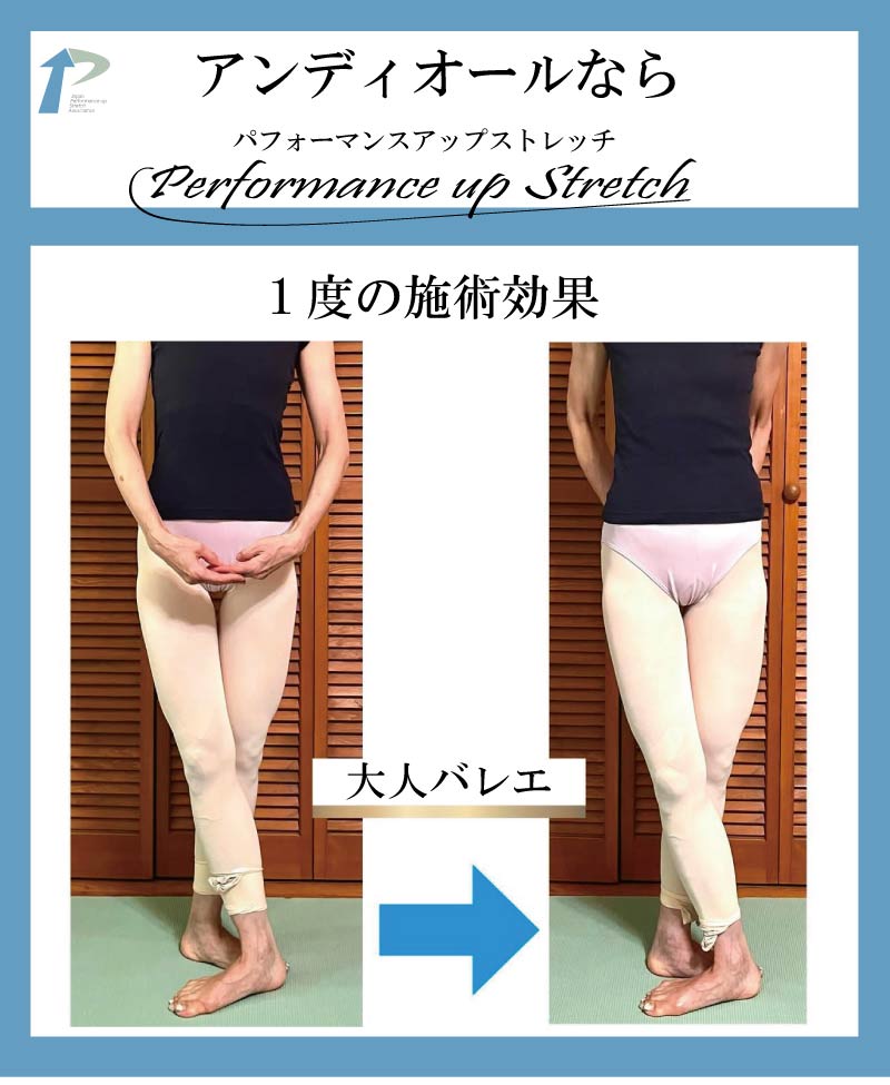 �o���G,����,�X�g���b�`,�A���f�B�I�[��