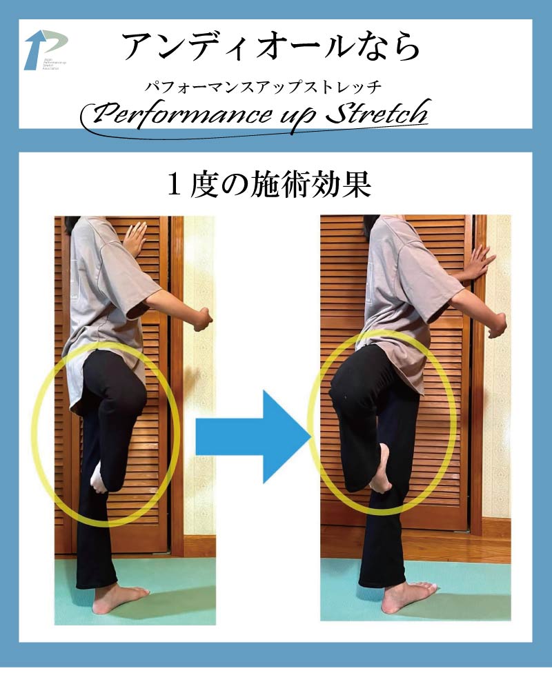 �o���G,����,�X�g���b�`,�A���f�B�I�[��