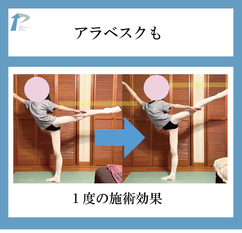 �o���G����,�X�g���b�`