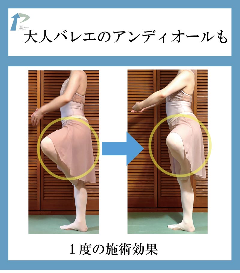 �o���G����,�X�g���b�`