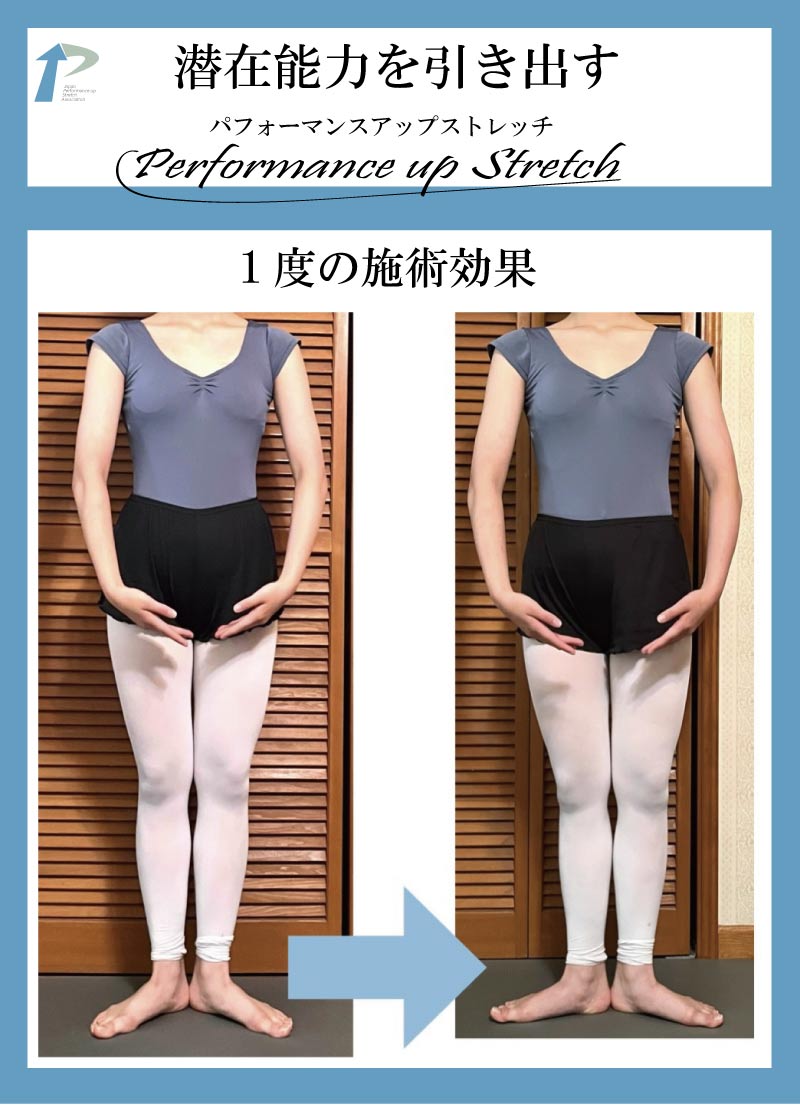 バレエ整体,柔軟性