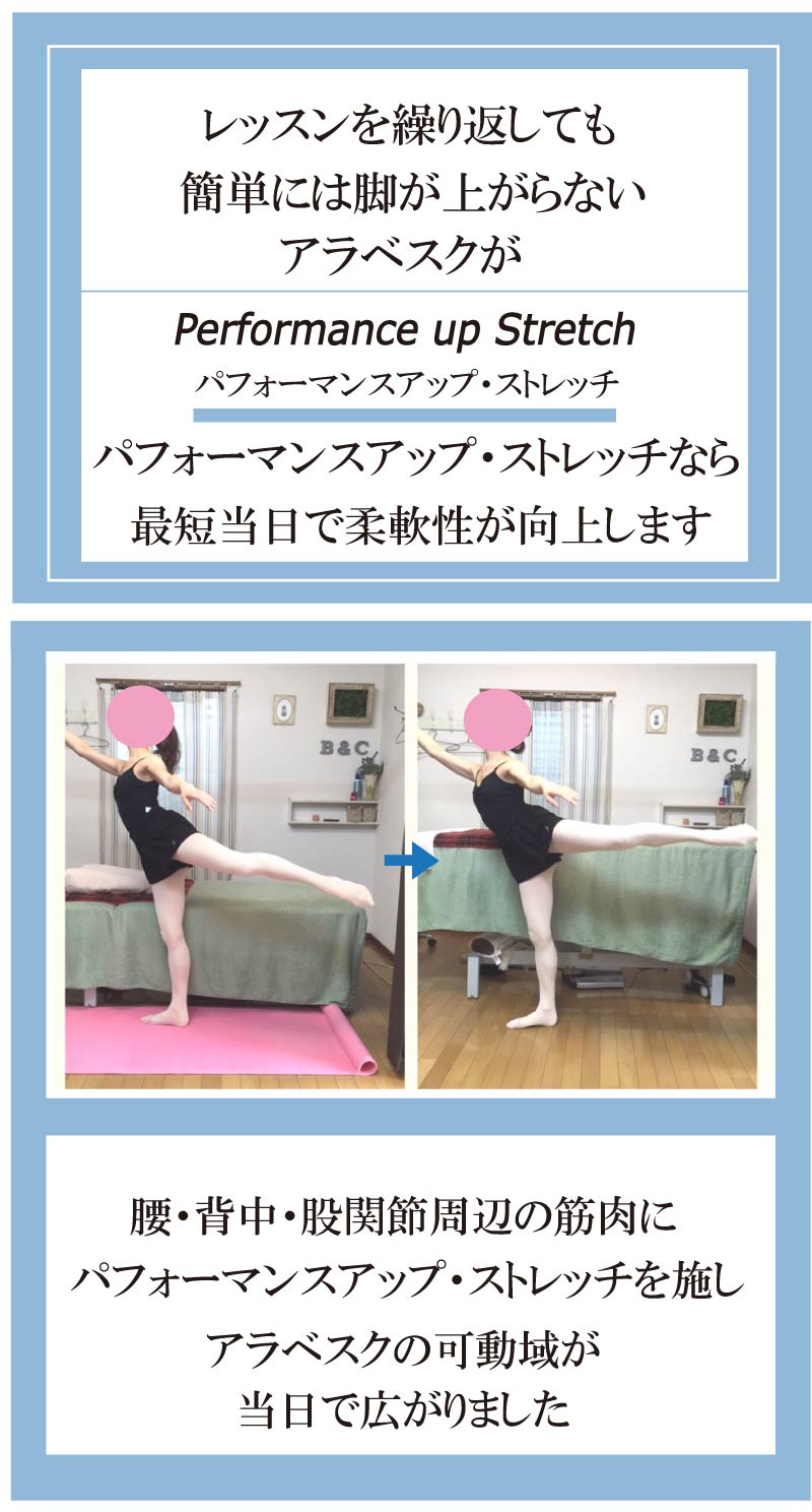 �o���G���̃X�g���b�`,�o���G����,�_�