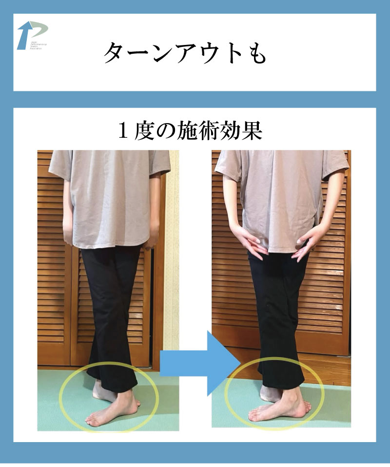 バレエ整体,東京,名古屋