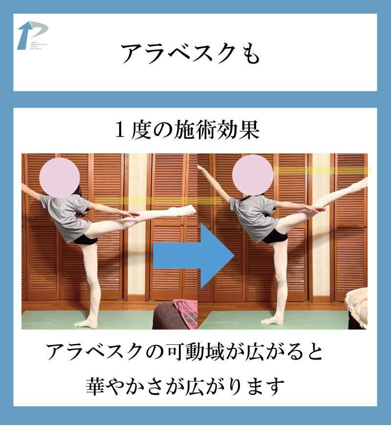 バレエ整体,関西,東京,名古屋