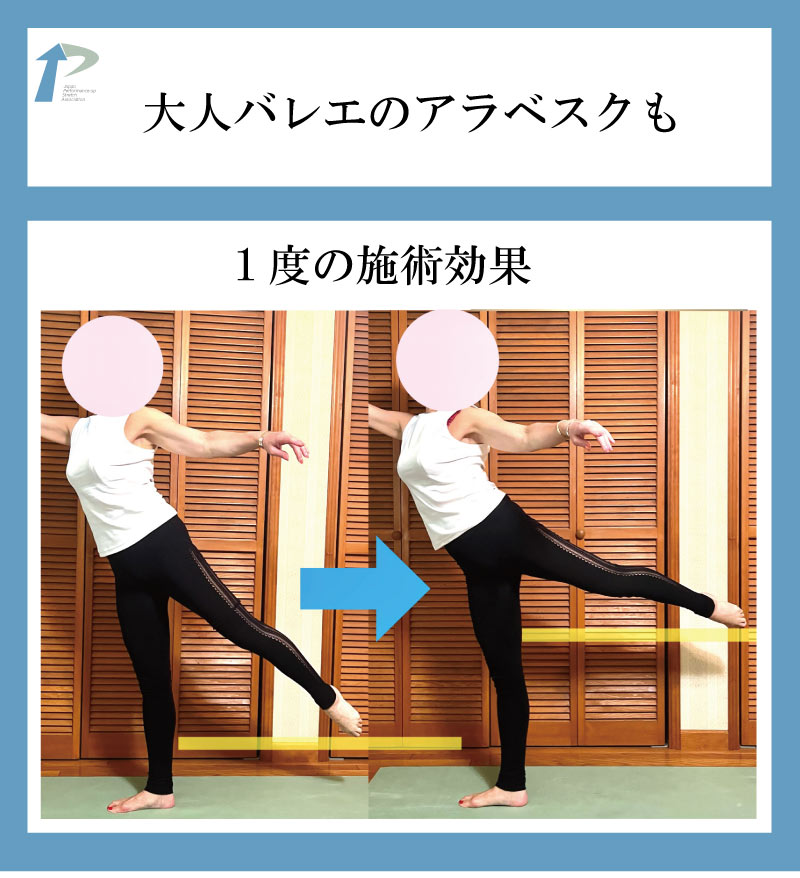 バレエ整体,東京,名古屋