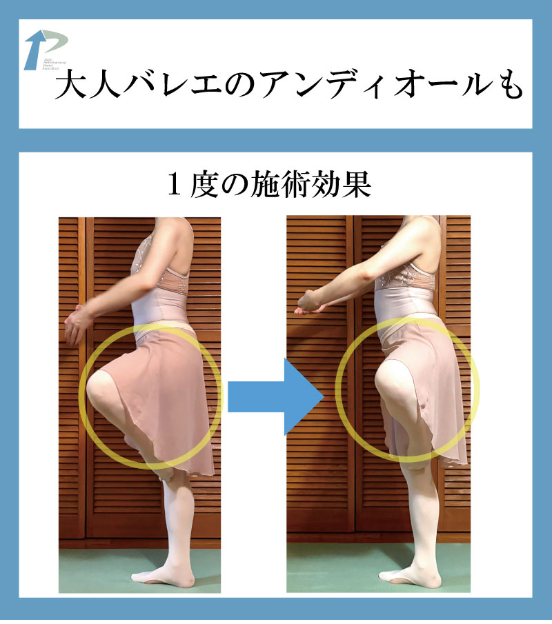 バレエ整体,東京,名古屋