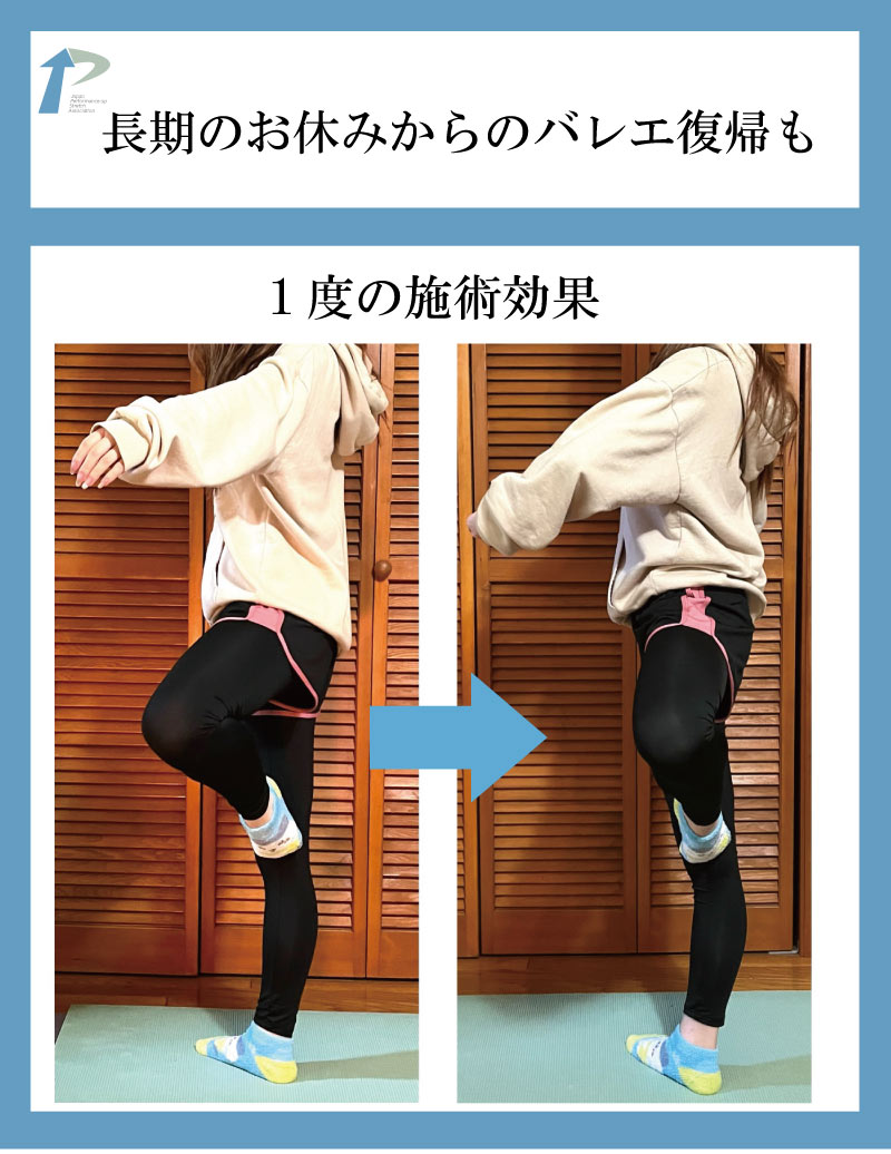 バレエ整体,東京,名古屋