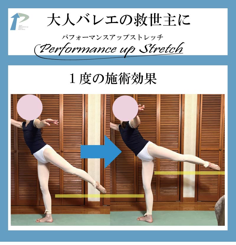 �o���G����,�o���G,�_�,�A���x�X�N