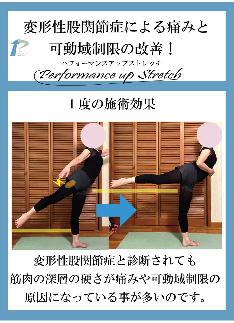 �o���G,����,���,�_�,�A���x�X�N