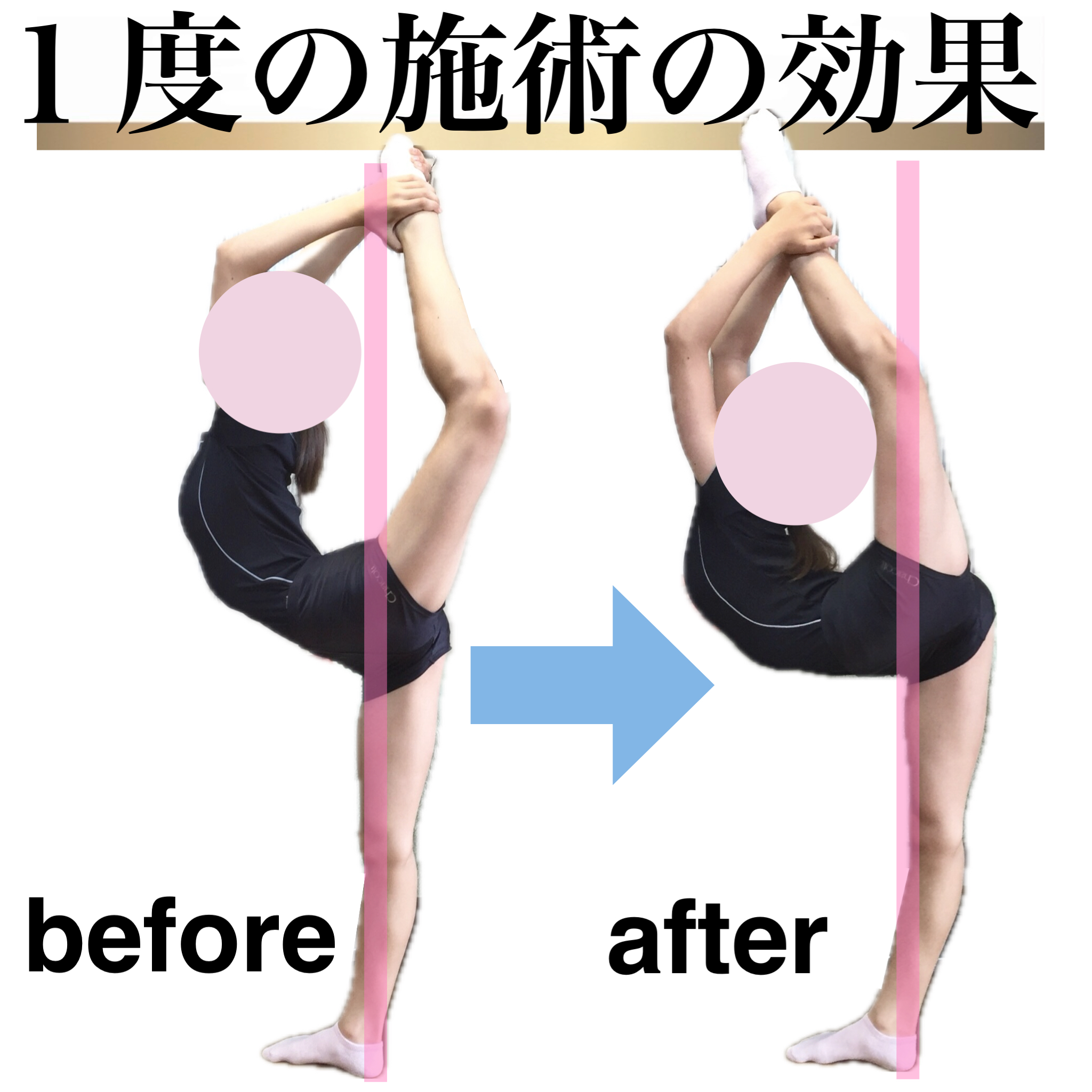 新体操,バレエ,資格,バレエ整体,新体操パフォーマンスアップストレッチトレーナー