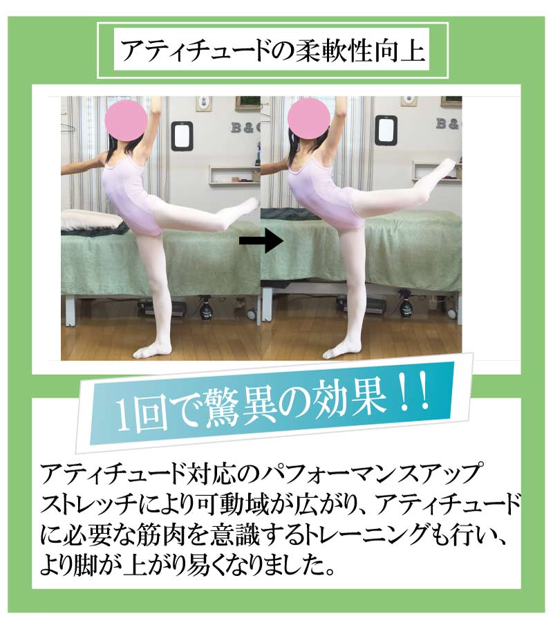 バレエ,整体,柔軟性,アティチュード