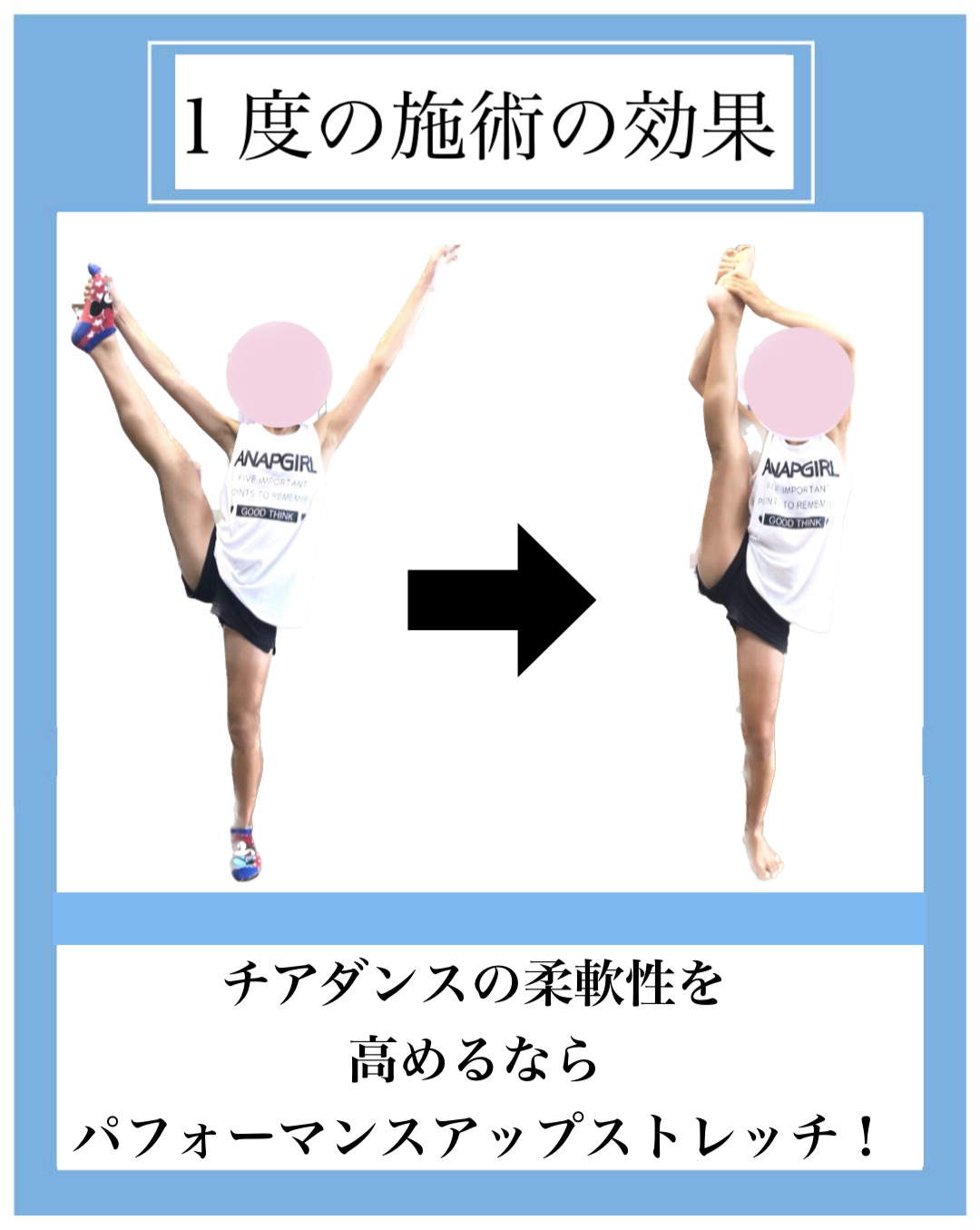 チアダンス,整体,柔軟性,ストレッチ,チアリーディング