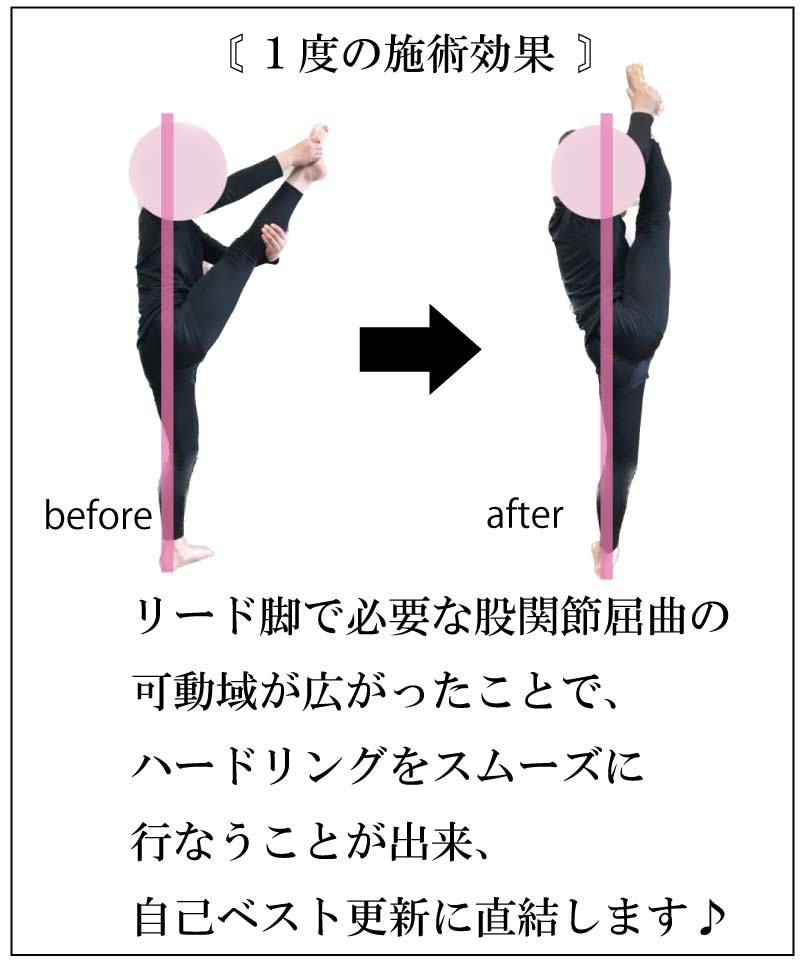 ハードル走力,足が速くなる,整体,ストレッチ,柔軟性