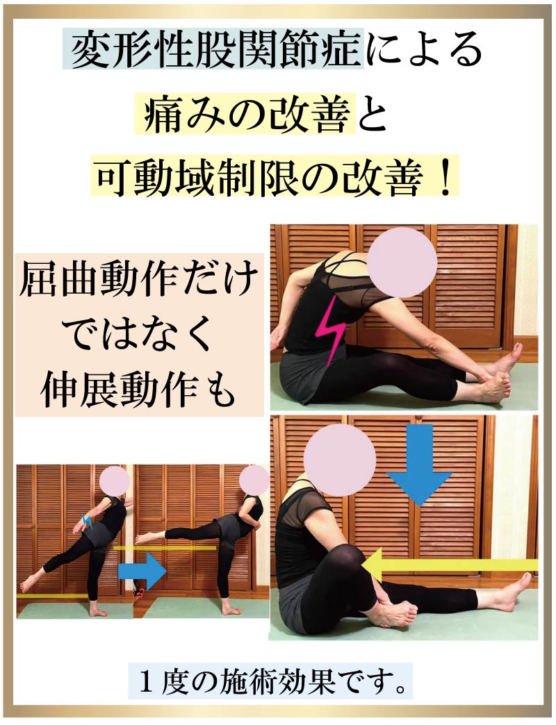 �o���G,����,�ɂ�,���P,�Ҋ֐ߒ�