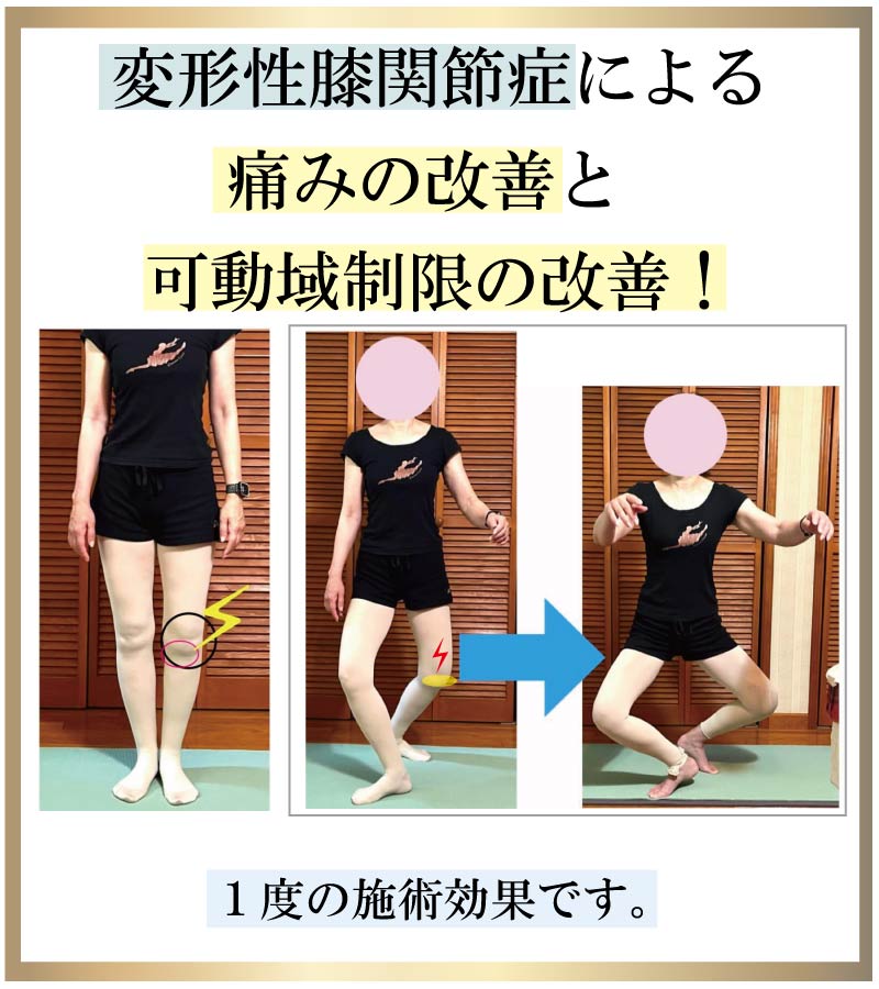 �o���G,����,�ɂ�,���P,�G�֐ߏ�