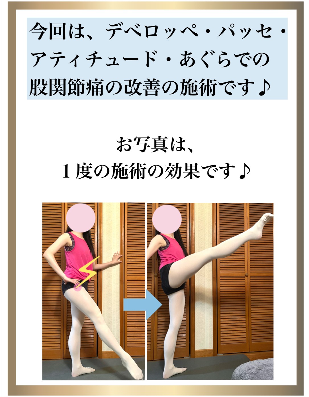 バレエ,整体,痛み,改善,股関節