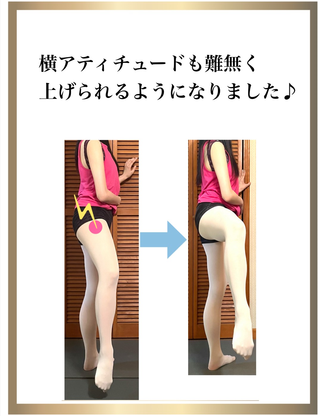 バレエ,整体,痛み,改善,股関節