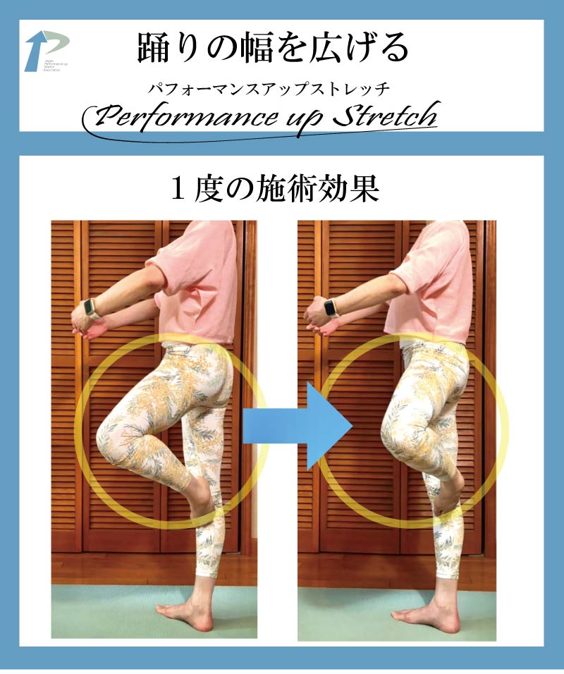 ��l,�o���G,����,�_�,�X�g���b�`