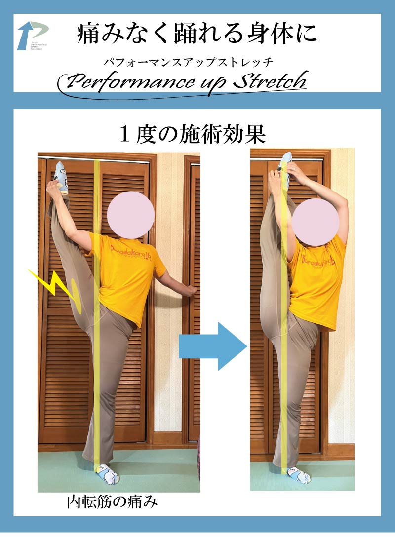 ��l,�o���G,����,�_�,�X�g���b�`