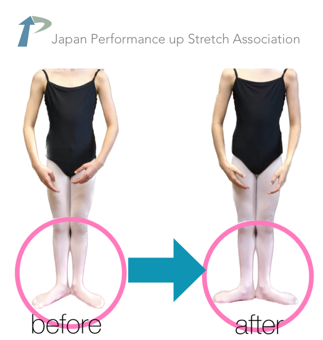 �k��[�w�X�g���b�`,�k��X�g���b�`,�p�t�H�[�}���X�A�b�v�X�g���b�`,�_�,����