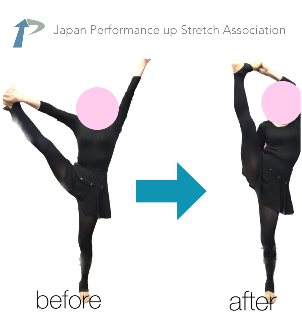 �k��[�w�X�g���b�`,�k��X�g���b�`,�p�t�H�[�}���X�A�b�v�X�g���b�`,�_�,����