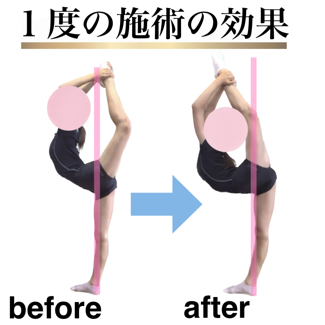 足が速くなる,ストレッチ,整体,方法