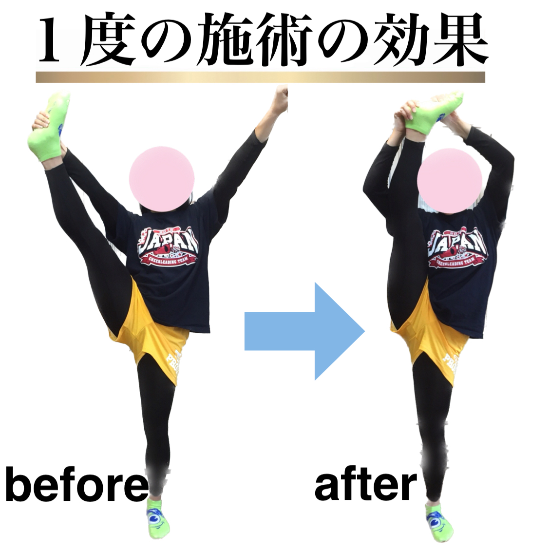 足が速くなる,ストレッチ,整体,方法