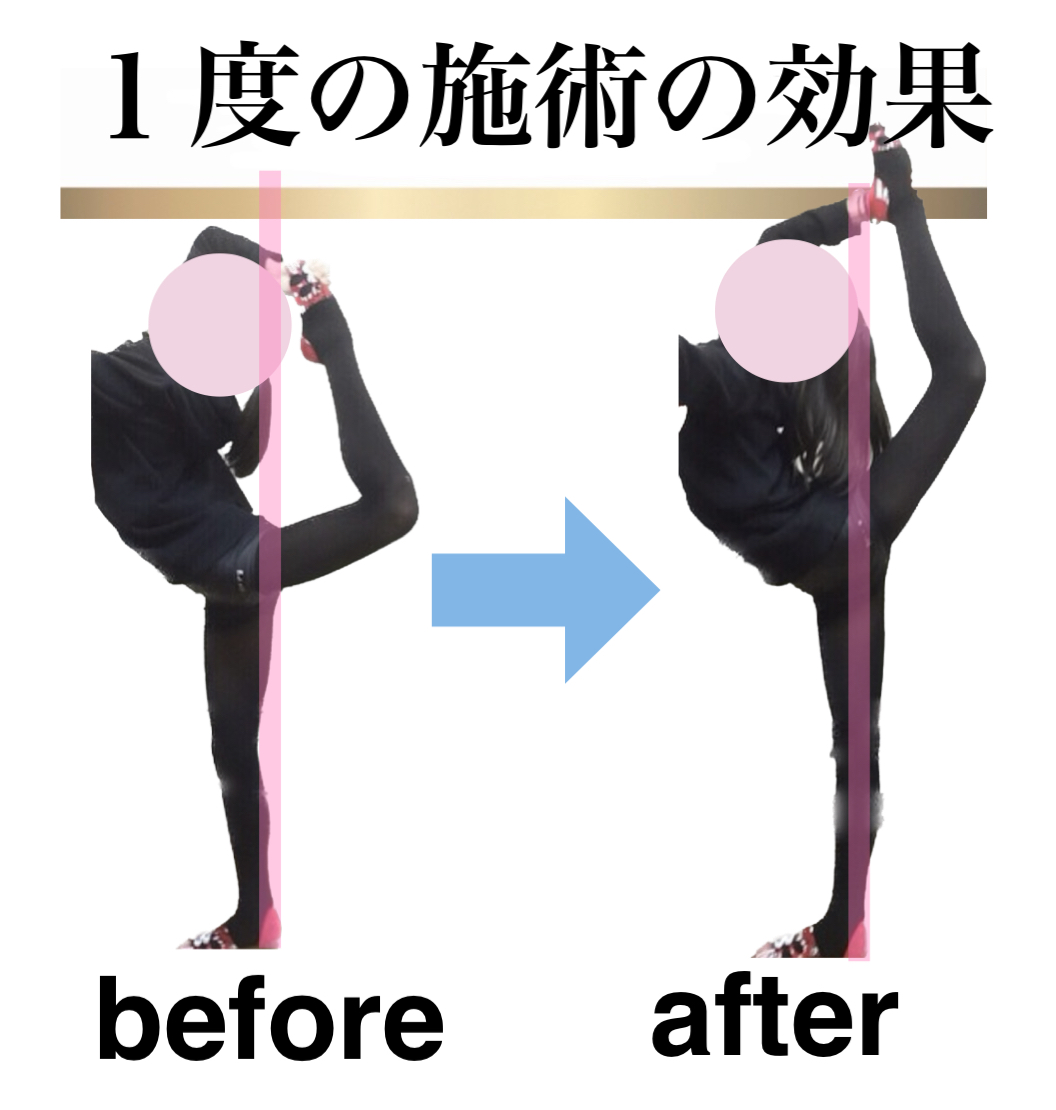 足が速くなる,ストレッチ,整体,方法