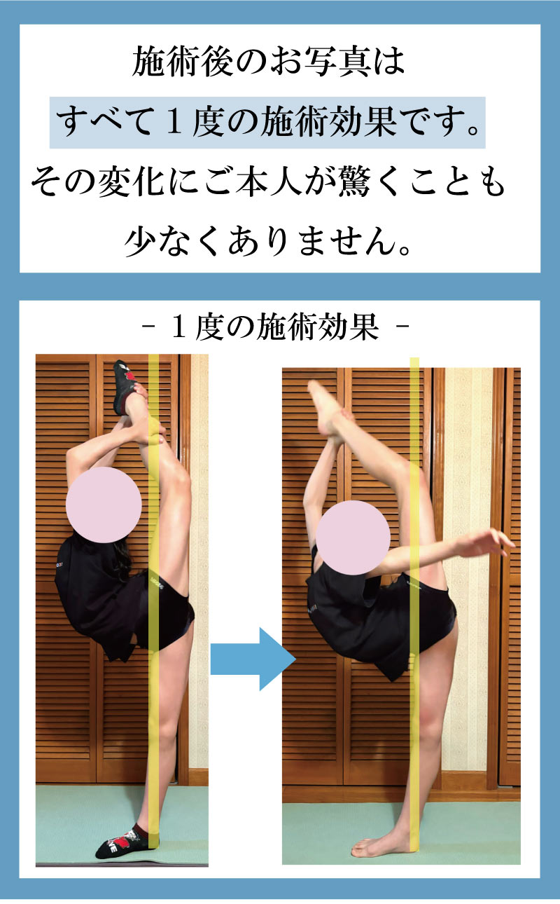 新体操,整体,柔軟性,ストレッチ